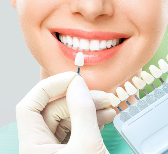 Clínica dental profesional en Málaga